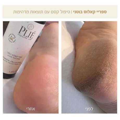 פליאה ספריי מסיר קאלוס בוטני